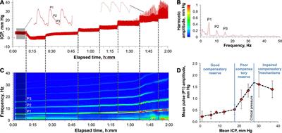 Large-Volume Intrathecal Administrations: Impact on CSF Pressure and Safety Implications